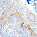 CD141 Antibody in Immunohistochemistry (Paraffin) (IHC (P))