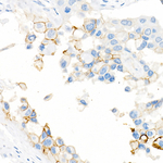 CD141 Antibody in Immunohistochemistry (Paraffin) (IHC (P))