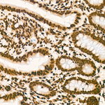 H3K79me1 Antibody in Immunohistochemistry (Paraffin) (IHC (P))
