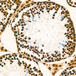 H3K79me1 Antibody in Immunohistochemistry (Paraffin) (IHC (P))