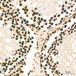 H3K79me1 Antibody in Immunohistochemistry (Paraffin) (IHC (P))