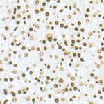 H3K36me2 Recombinant Rabbit Monoclonal Antibody (8A7Q9)