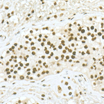 H3K36me2 Antibody in Immunohistochemistry (Paraffin) (IHC (P))