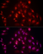 H4K20me2 Recombinant Rabbit Monoclonal Antibody (1E8Q2)