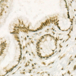 H4K20me2 Antibody in Immunohistochemistry (Paraffin) (IHC (P))