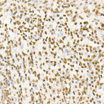 H4K20me2 Antibody in Immunohistochemistry (Paraffin) (IHC (P))