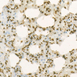 H4K20me2 Antibody in Immunohistochemistry (Paraffin) (IHC (P))