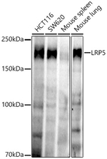 LRP5 Recombinant Rabbit Monoclonal Antibody (5N5M5)