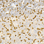 CD3 Antibody in Immunohistochemistry (Paraffin) (IHC (P))