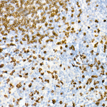 CD3 Antibody in Immunohistochemistry (Paraffin) (IHC (P))