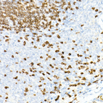 CD3 Antibody in Immunohistochemistry (Paraffin) (IHC (P))