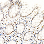 SRSF1 Antibody in Immunohistochemistry (Paraffin) (IHC (P))
