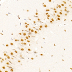 SRSF1 Antibody in Immunohistochemistry (Paraffin) (IHC (P))