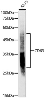 CD63 Antibody in Western Blot (WB)