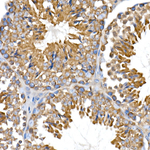 DAP5 Antibody in Immunohistochemistry (Paraffin) (IHC (P))