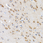 DAP5 Antibody in Immunohistochemistry (Paraffin) (IHC (P))