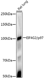 DAP5 Antibody in Western Blot (WB)