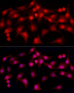 Estrogen Receptor alpha Antibody in Immunocytochemistry (ICC/IF)