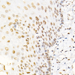 SMARCB1 Antibody in Immunohistochemistry (Paraffin) (IHC (P))