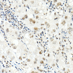 SMARCB1 Antibody in Immunohistochemistry (Paraffin) (IHC (P))