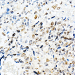 SMARCB1 Recombinant Rabbit Monoclonal Antibody (9O7T7)