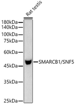 SMARCB1 Antibody in Western Blot (WB)