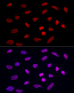 H3R8me2s Antibody in Immunocytochemistry (ICC/IF)