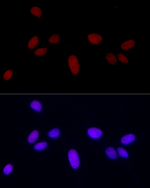 H3R8me2s Antibody in Immunocytochemistry (ICC/IF)