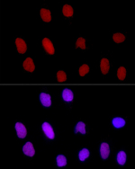 H3R8me2s Antibody in Immunocytochemistry (ICC/IF)