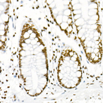 H3R8me2s Antibody in Immunohistochemistry (Paraffin) (IHC (P))