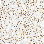 H3R8me2s Antibody in Immunohistochemistry (Paraffin) (IHC (P))