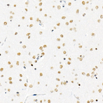 H3R8me2s Antibody in Immunohistochemistry (Paraffin) (IHC (P))