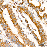 PLOD3 Antibody in Immunohistochemistry (Paraffin) (IHC (P))
