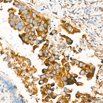 PLOD3 Antibody in Immunohistochemistry (Paraffin) (IHC (P))