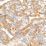 PLOD3 Antibody in Immunohistochemistry (Paraffin) (IHC (P))