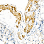VDAC2 Antibody in Immunohistochemistry (Paraffin) (IHC (P))