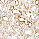 VDAC2 Antibody in Immunohistochemistry (Paraffin) (IHC (P))