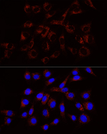 RAB7A Recombinant Rabbit Monoclonal Antibody (7W1R5)