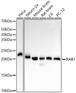 RAB7A Antibody in Western Blot (WB)