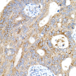 IGF2R Recombinant Rabbit Monoclonal Antibody (8W8A8)