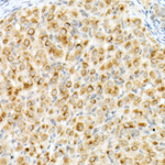 IGF2R Antibody in Immunohistochemistry (Paraffin) (IHC (P))