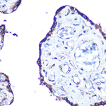 LC3A Recombinant Rabbit Monoclonal Antibody (10G1E8)