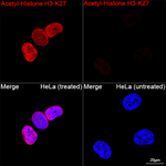 H3K27ac Recombinant Rabbit Monoclonal Antibody (4H9K6)