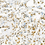 H3K27ac Antibody in Immunohistochemistry (Paraffin) (IHC (P))
