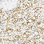 H3K27ac Antibody in Immunohistochemistry (Paraffin) (IHC (P))