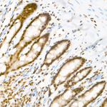 H3K27ac Antibody in Immunohistochemistry (Paraffin) (IHC (P))