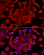 ALDH1A1 Antibody in Immunocytochemistry (ICC/IF)