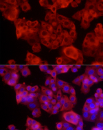 ALDH1A1 Recombinant Rabbit Monoclonal Antibody (5G0T8)