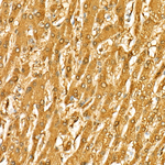 ALDH1A1 Antibody in Immunohistochemistry (Paraffin) (IHC (P))