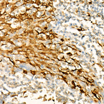 ALDH1A1 Antibody in Immunohistochemistry (Paraffin) (IHC (P))